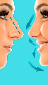Descargar Rinoplastia: editor de nariz Belleza para Android captura de pantalla 4